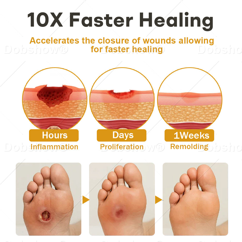🔥Best Seller🔥Healrize® GlucoShield Bee Venom Wound Spray 🎉Special limited-time discount