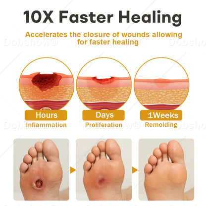 🔥Best Seller🔥Healrize® GlucoShield Bee Venom Wound Spray 🎉Special limited-time discount