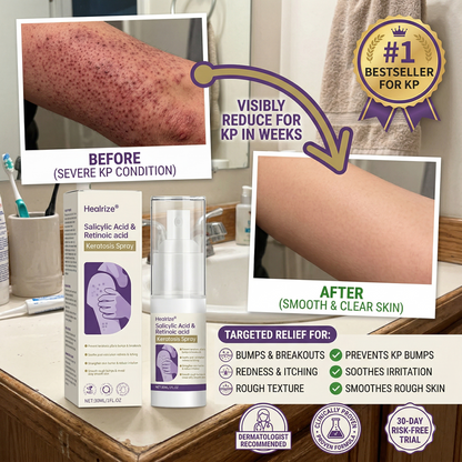 🎉Limited-time discount✨Healrize® Salicylic Acid & Retinoic acid Keratosis Spray| keratosis pilaris on arms & body