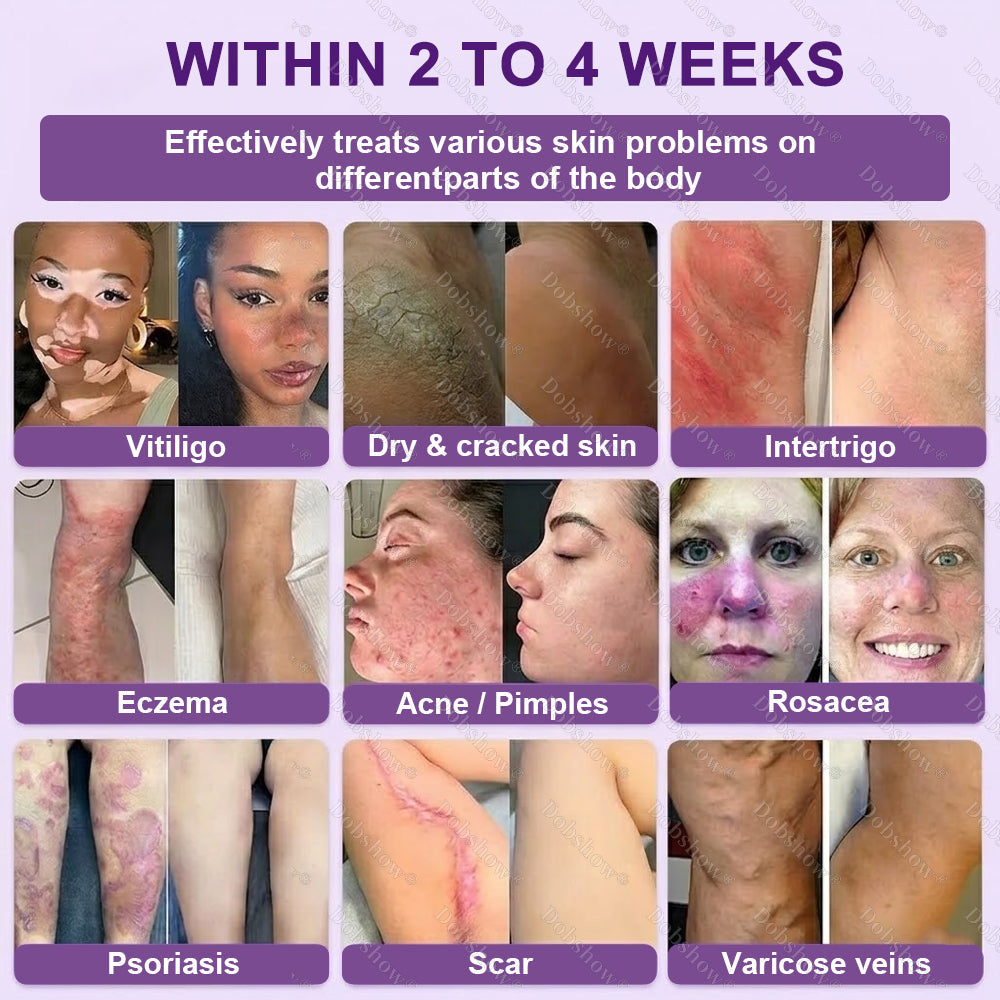 ✨Best Seller🔥Healrize® Biotin 10-in-1 Skin Restoration Cream 🎉Special limited-time discount