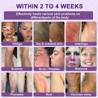 ✨Best Seller🔥Healrize® Biotin 10-in-1 Skin Restoration Cream 🎉Special limited-time discount