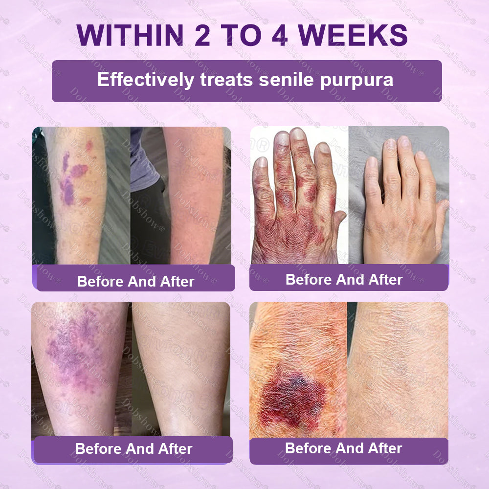 ✨Best Seller🔥Healrize® Biotin 10-in-1 Skin Restoration Cream 🎉Special limited-time discount