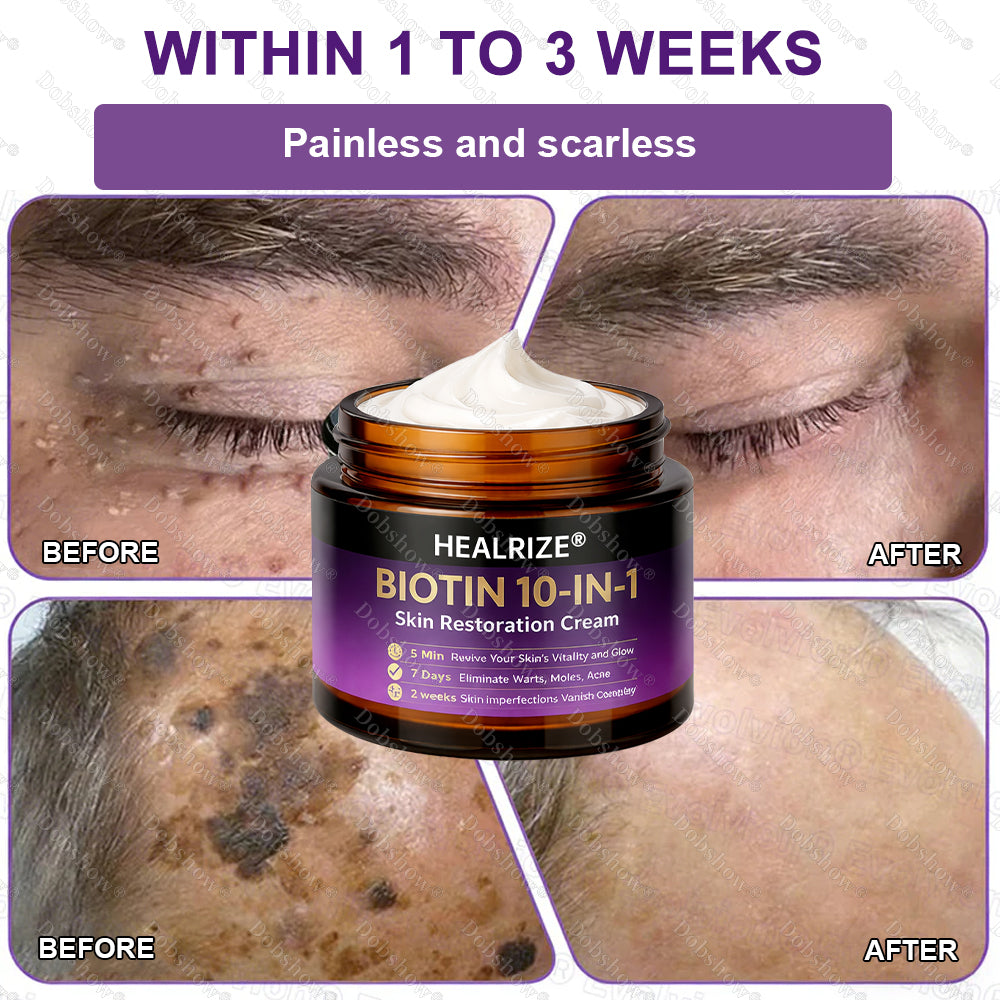 ✨Best Seller🔥Healrize® Biotin 10-in-1 Skin Restoration Cream 🎉Special limited-time discount