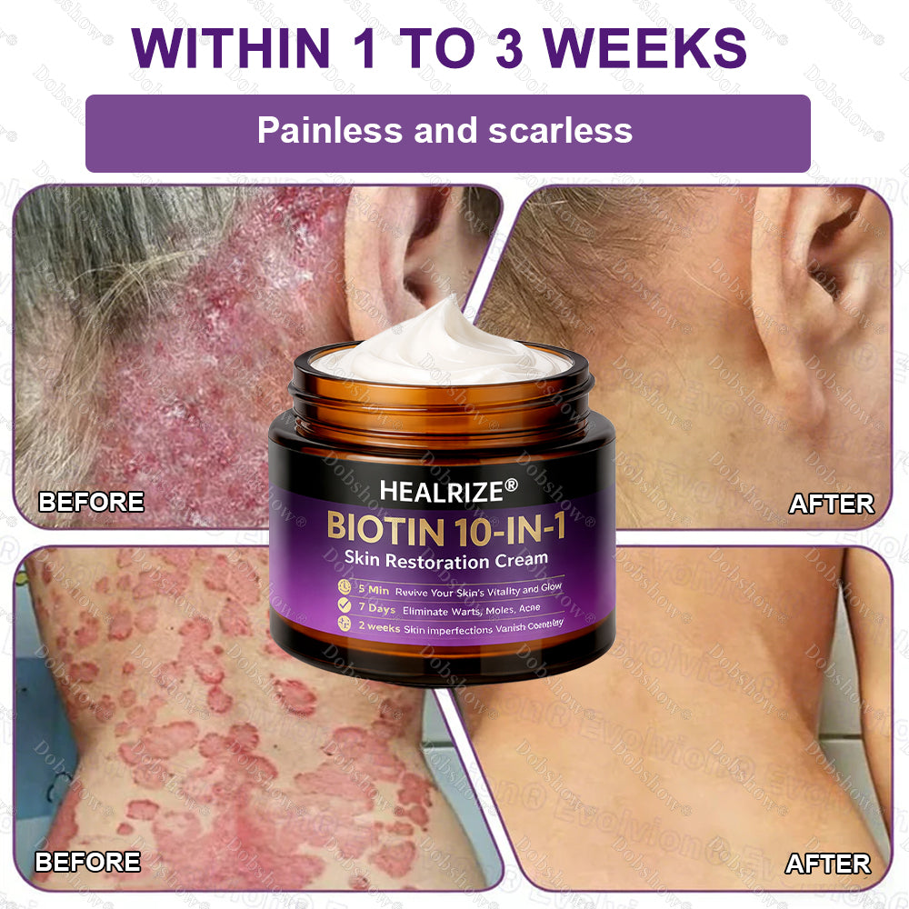 ✨Best Seller🔥Healrize® Biotin 10-in-1 Skin Restoration Cream 🎉Special limited-time discount