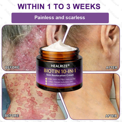 ✨Best Seller🔥Healrize® Biotin 10-in-1 Skin Restoration Cream 🎉Special limited-time discount
