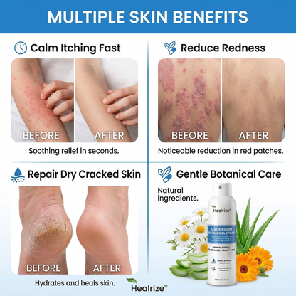 `Healrize® Magnesium Botanical Spray – Advanced Skin Recovery for Psoriasis & Eczema | Rapid Soothing, Steroid-Free