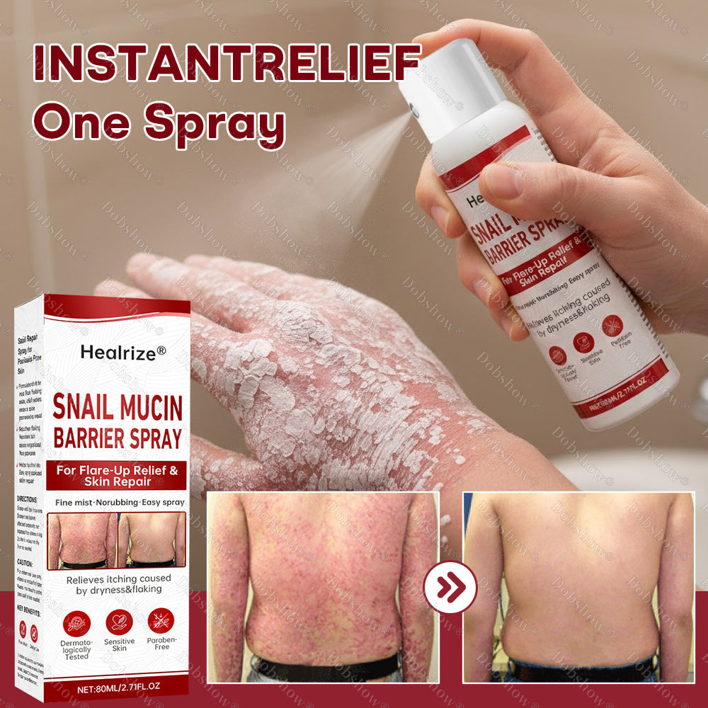 ·Healrize® Snail Mucin Barrier Spray for Flare-Up Relief & Skin Repai