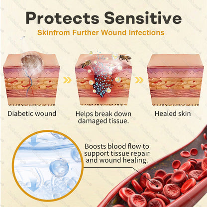 Healrize®Bee Venom Intensive Diabetic Foot Treatment Spray