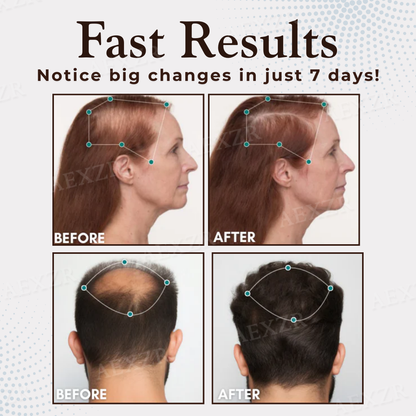 Healrize® Hair Regrowth Capsules| Revive Follicles, Boost Hair Volume