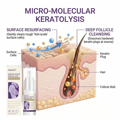 🎉Limited-time discount✨Healrize® Salicylic Acid & Retinoic acid Keratosis Spray| keratosis pilaris on arms & body