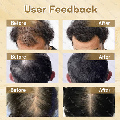 🔥𝙇𝙞𝙢𝙞𝙩𝙚𝙙-𝙏𝙞𝙢𝙚 𝙊𝙛𝙛𝙚𝙧 | Healrize® Hair Regrowth Capsules | Nano Penetration, Deep into Hair Roots