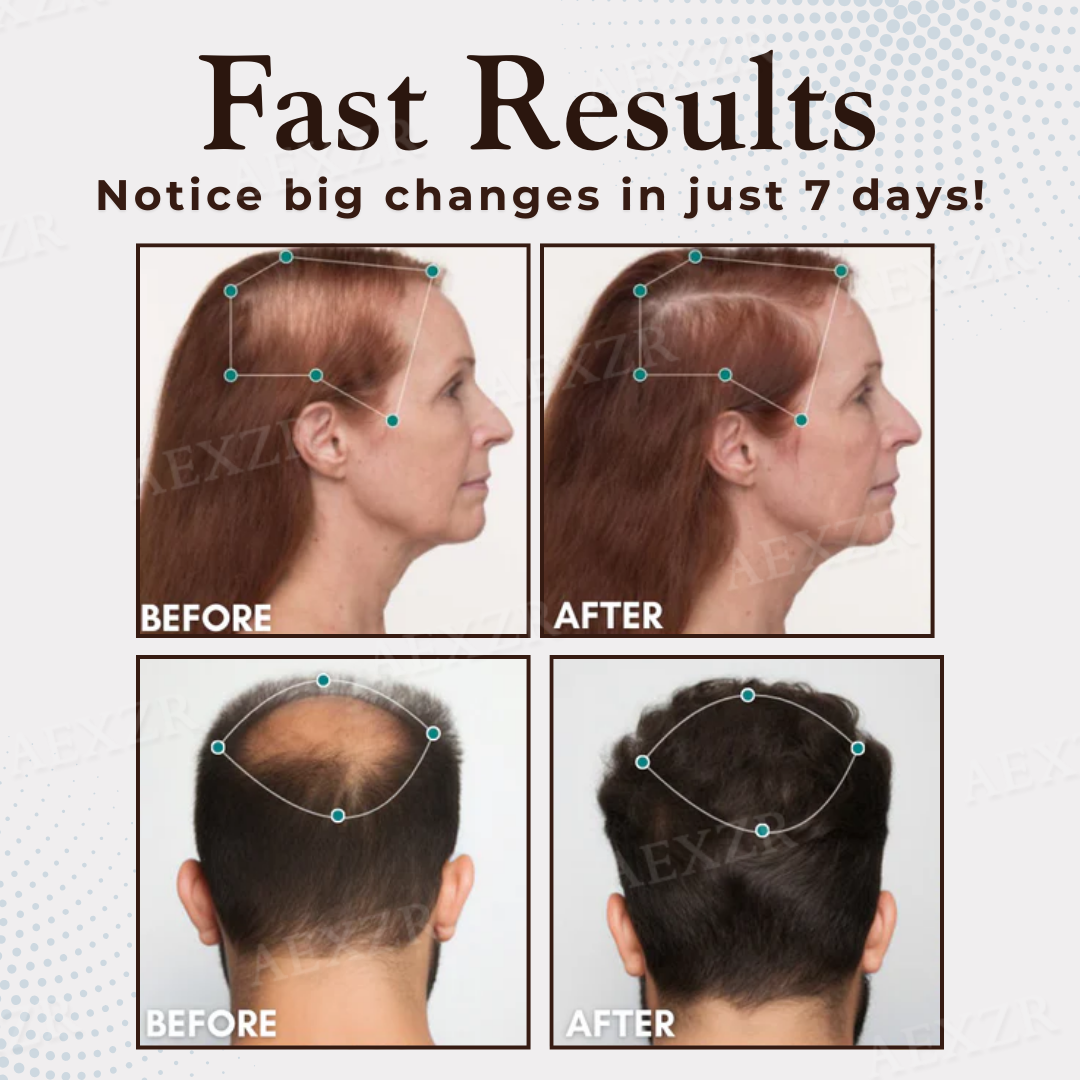 Best Seller 🎉limited-time discount| Healrize® Hair Regrowth Capsules 💖Revive Follicles, Boost Hair Volume