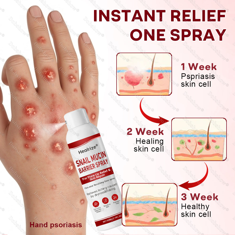 ·Healrize® Snail Mucin Barrier Spray for Flare-Up Relief & Skin Repai
