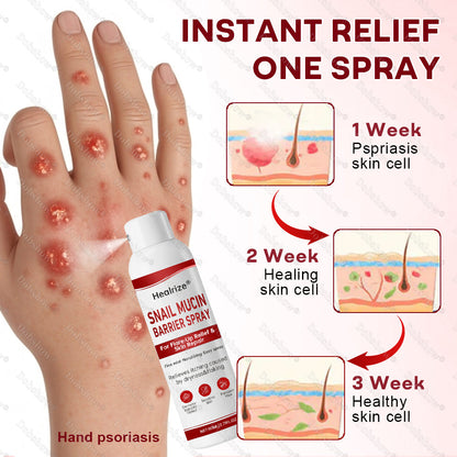 ·Healrize® Snail Mucin Barrier Spray for Flare-Up Relief & Skin Repai