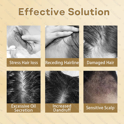 🔥𝙇𝙞𝙢𝙞𝙩𝙚𝙙-𝙏𝙞𝙢𝙚 𝙊𝙛𝙛𝙚𝙧 | Healrize® Hair Regrowth Capsules | Nano Penetration, Deep into Hair Roots