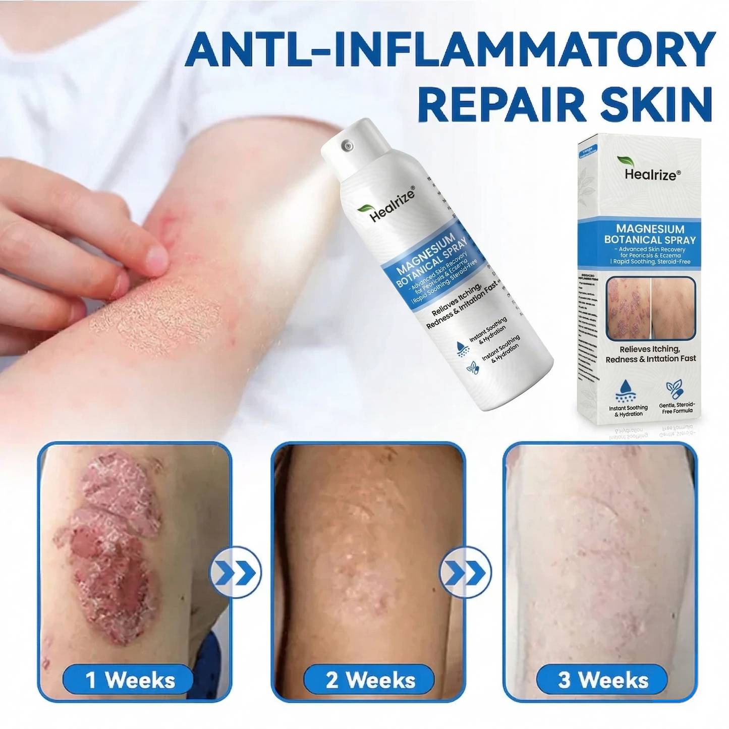 `Healrize® Magnesium Botanical Spray – Advanced Skin Recovery for Psoriasis & Eczema | Rapid Soothing, Steroid-Free