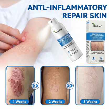 `Healrize® Magnesium Botanical Spray – Advanced Skin Recovery for Psoriasis & Eczema | Rapid Soothing, Steroid-Free
