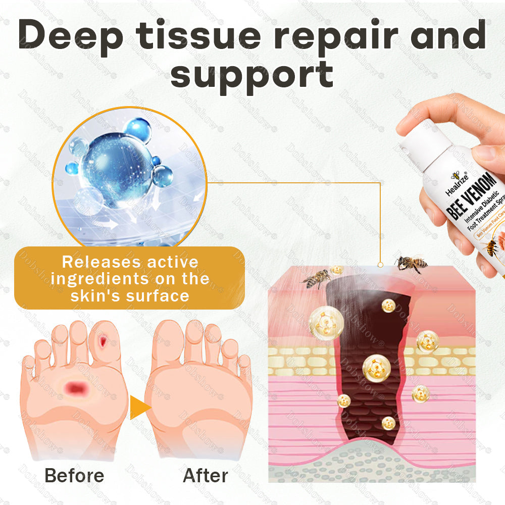 Healrize®Bee Venom Intensive Diabetic Foot Treatment Spray