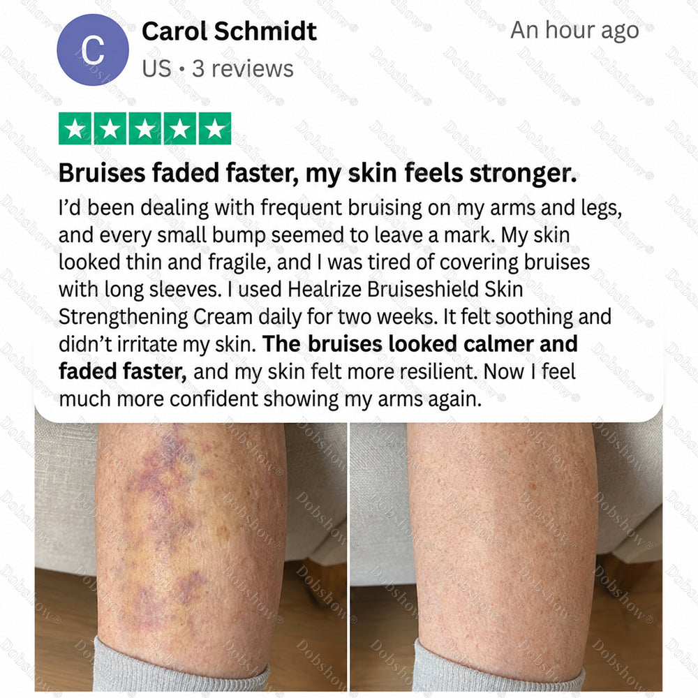 Healrize® BruiseShield Skin Strengthening Cream