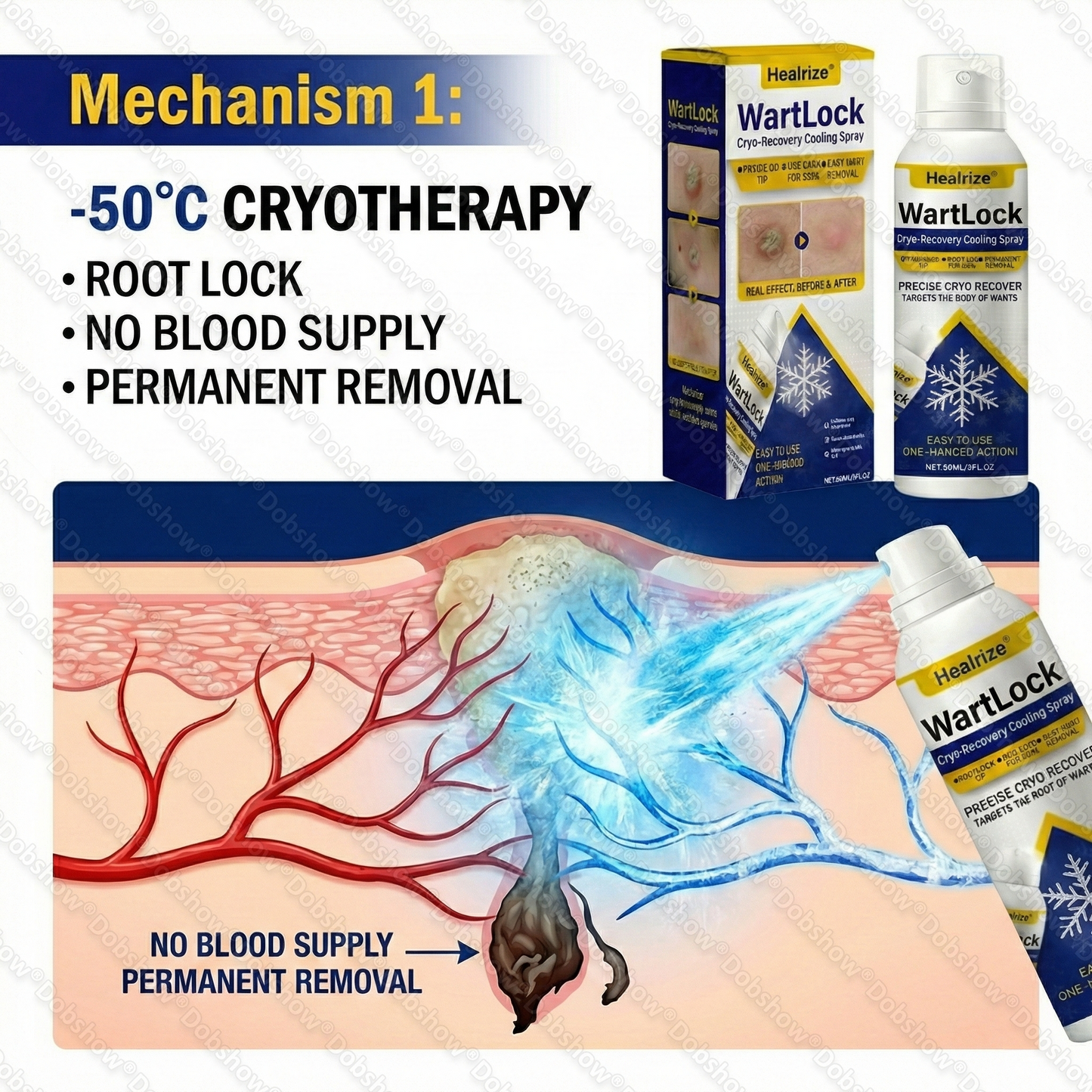 🔥Best Seller🔥Healrize® WartLock Cryo-Recovery Cooling Spray🎉Special limited-time discount