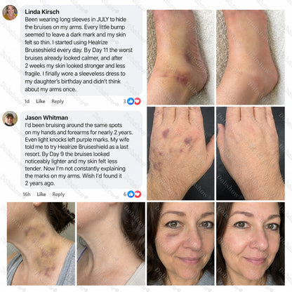 Healrize® BruiseShield Skin Strengthening Cream