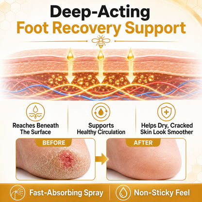 Healrize®Bee Venom Intensive Diabetic Foot Treatment Spray