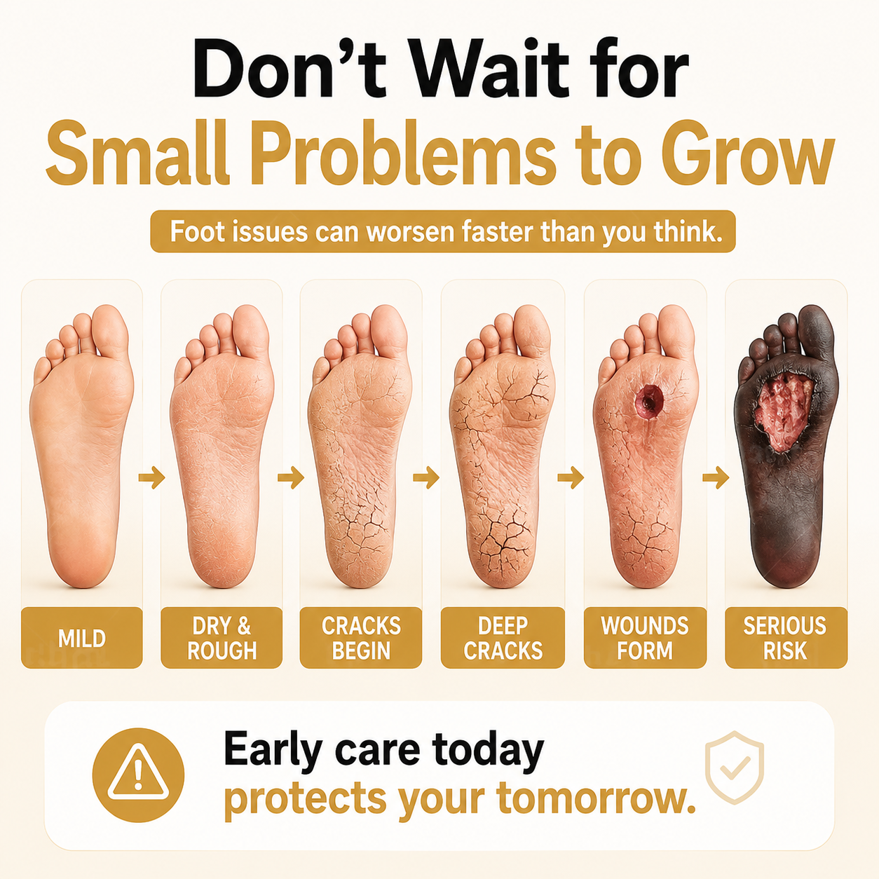 Healrize®Bee Venom Intensive Diabetic Foot Treatment Spray