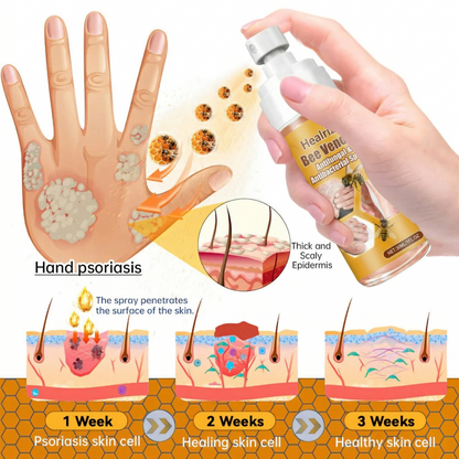 🔥Best Seller🔥Healrize® Bee Venom Antifungal & Antibacterial Spray– Advanced Skin Recovery for Psoriasis & Eczema🎉Special Limited Time 50% OFF